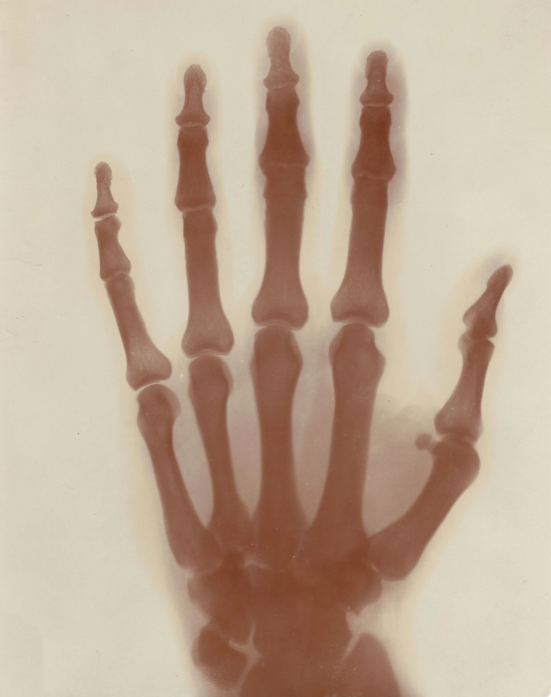 X-ray photograph of Nikola Tesla’s left hand from about 1896, every finger bone visible, with 21 tracking points marked on its joints